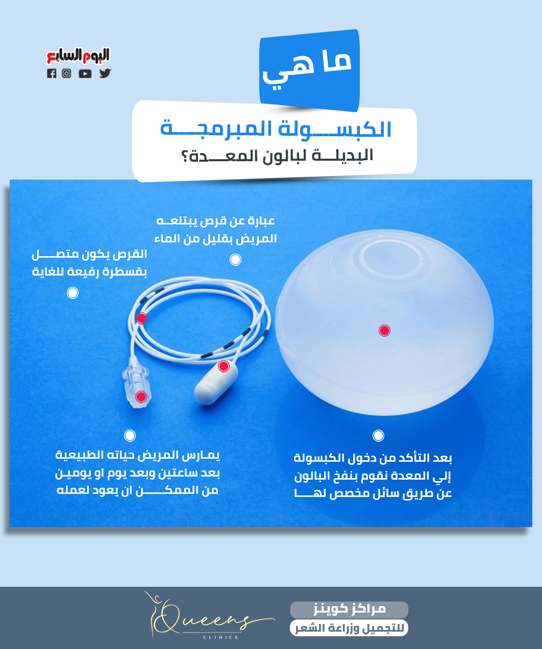 جلوبال 2: تم منح موافقة IDE الرابعة لـ Concept Medical لبالون MagicTouch المطلي بالسيروليموس لعلاج مرض الشريان الفخذي السطحي (SFA) 1 1474582 ما هي الكبسولة المبرمجة البديلة لبالون المعدة؟1685427663