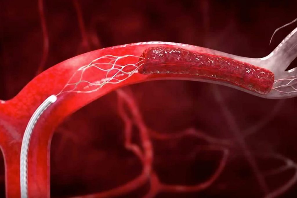 دراسة أمريكية: مشاكل الأوعية الدموية في العين تزيد من مخاطر الإصابة بالزهايمر 1 2018 9 12 15 6 13 9661684669563