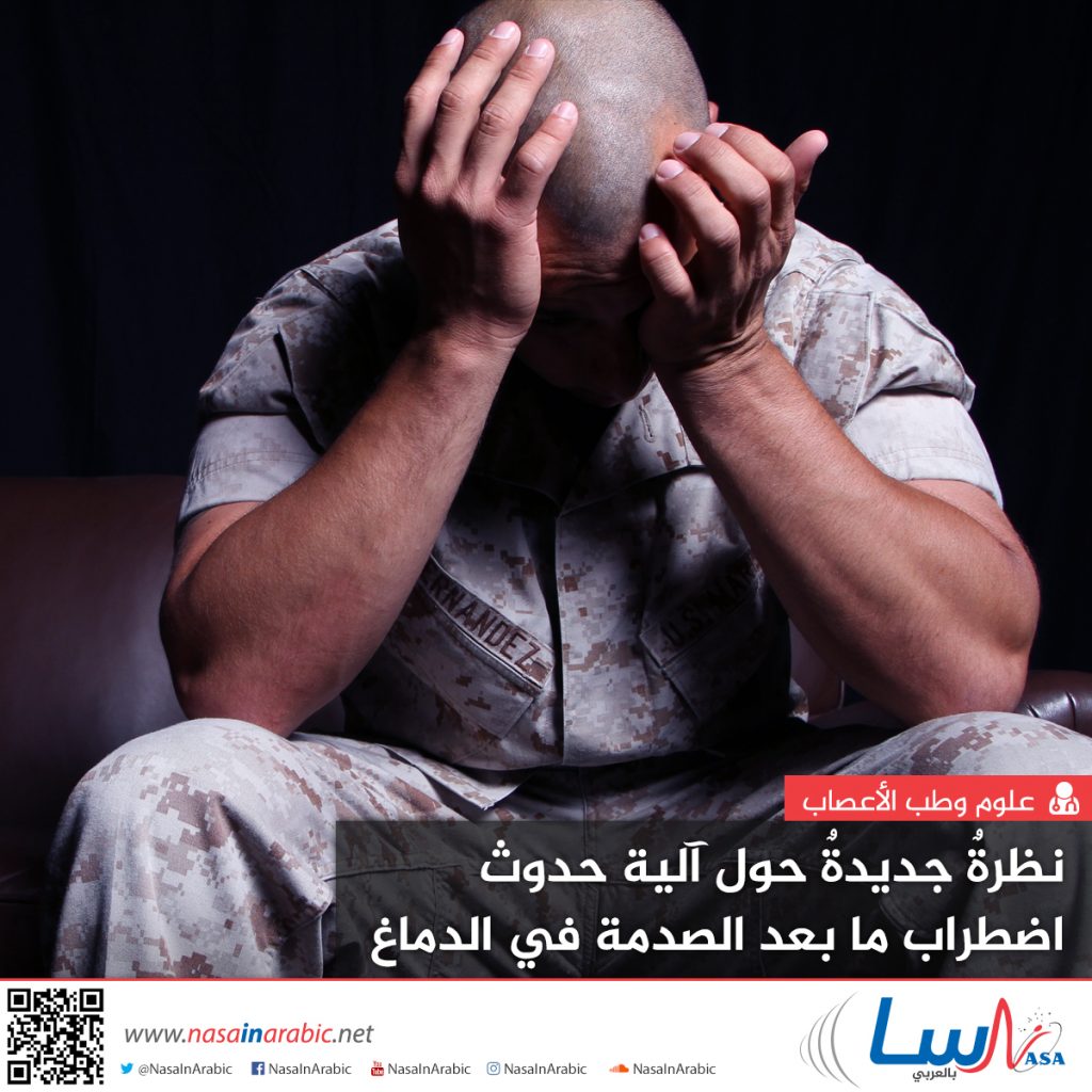 دراسة أمريكية تكشف ارتباط اضطراب مابعد الصدمة بمنطقة "المخيخ" في الدماغ 1 c3a4b83d72601ab03b56115a7c26575a1705353183