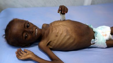 349356 أطفال اليمن يعانون من سوء التغذية1709144344