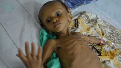161008121740 children in the province are at risk of severe malnutrition 640x360 ap nocredit1713260644