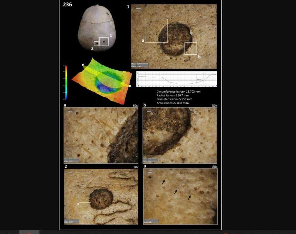 1000780765