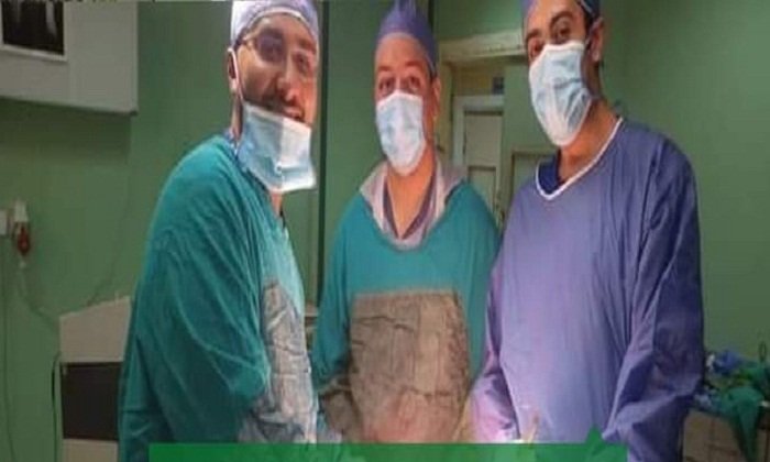 فريق طبي بمستشفى قنا العام ينجح في علاج فتق ضخم معقد لسيدة باستخدام تقنيّة جراحية جديدة 1 elaosboa68192 21720185123