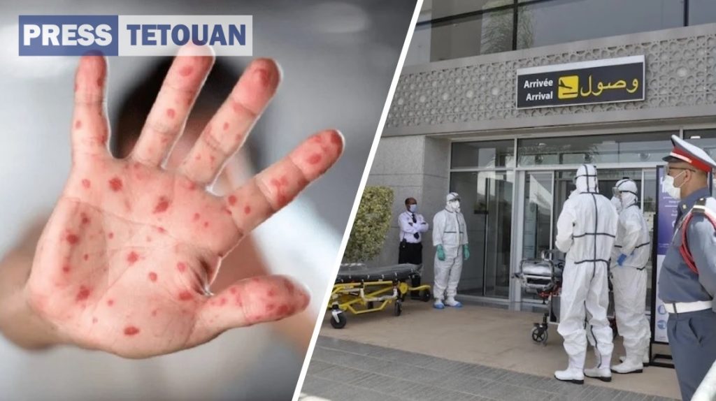 الهند: توجيهات بتوخي الحذر في المطارات والموانئ بسبب جدري القردة 1 بريس تطوان 31724142844