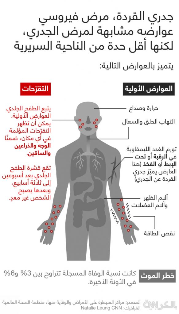 الإيسيسكو تنشر دراسة حول جدري القردة أعدتها جامعة حماة السورية 1 2134611724348223