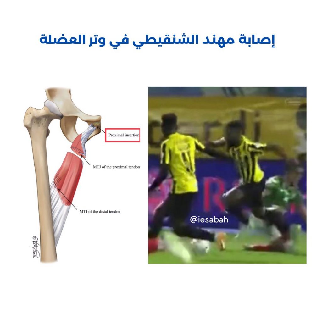 أوديجارد يجري مزيداً من الفحوصات الطبية بعد إصابته في الكاحل 1 FpMOn9IXEAA2e1F1726077124