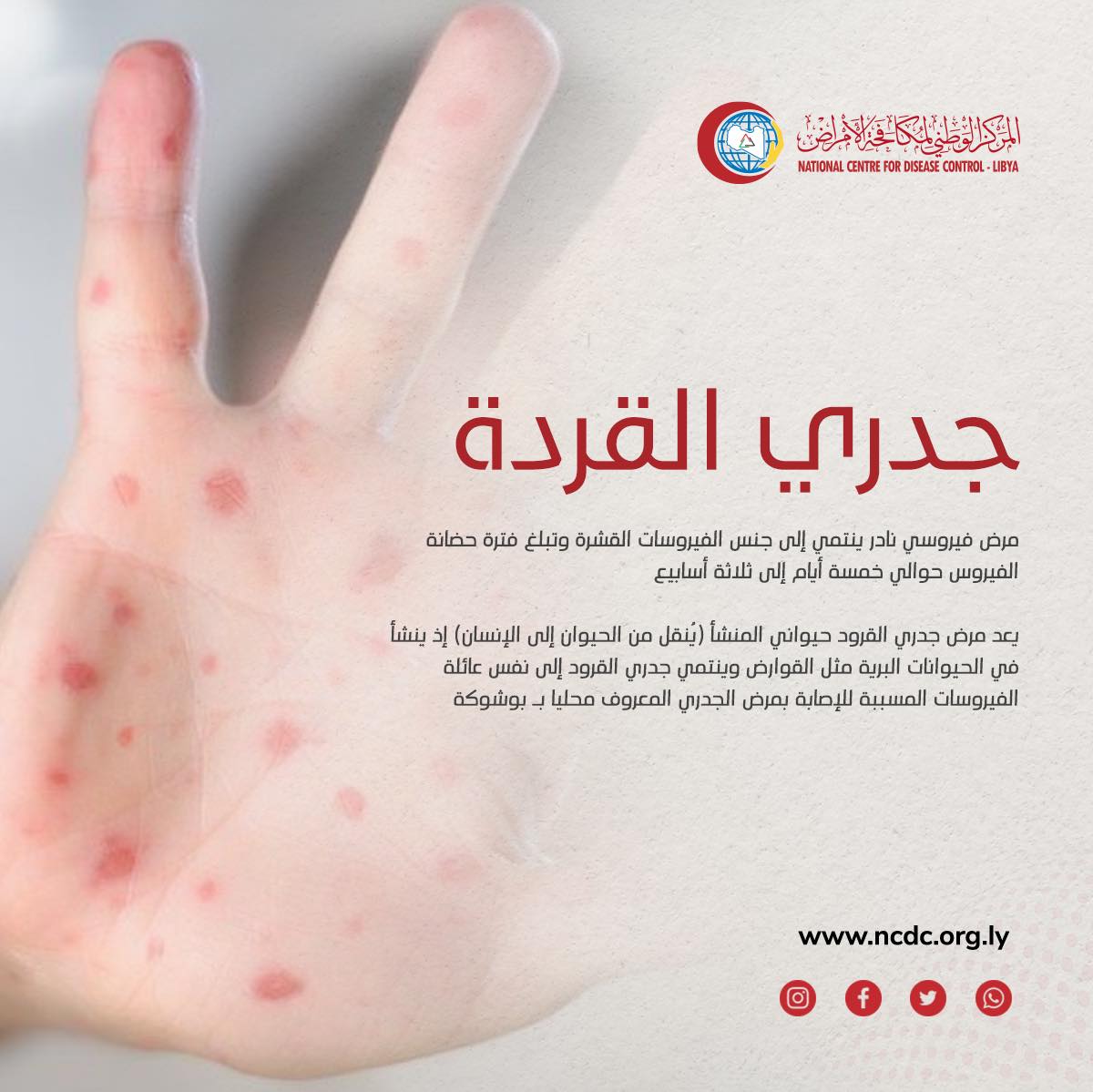 المراكز الإفريقية لمكافحة الأمراض: لقاح جدري القرود آمن تماما ولم يتسبب في حالات وفاة 1 2542631728195786